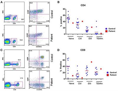 Cytomegalovirus Colitis in Primary Hypogammaglobulinemia With Normal CD4+ T Cells: Deficiency of CMV-Specific CD8+ T Cells